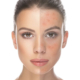 tudo-sobre-acne
